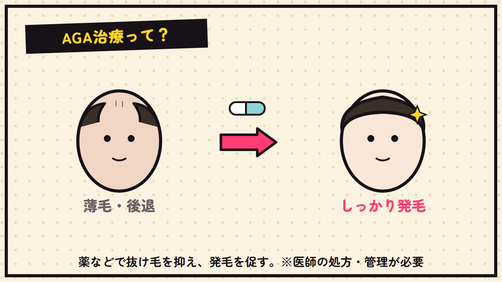 AGA治療の図解（薄毛→発毛）