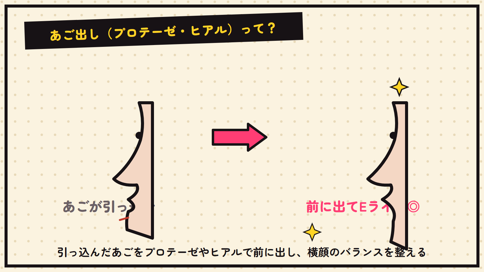 あご出しの図解
