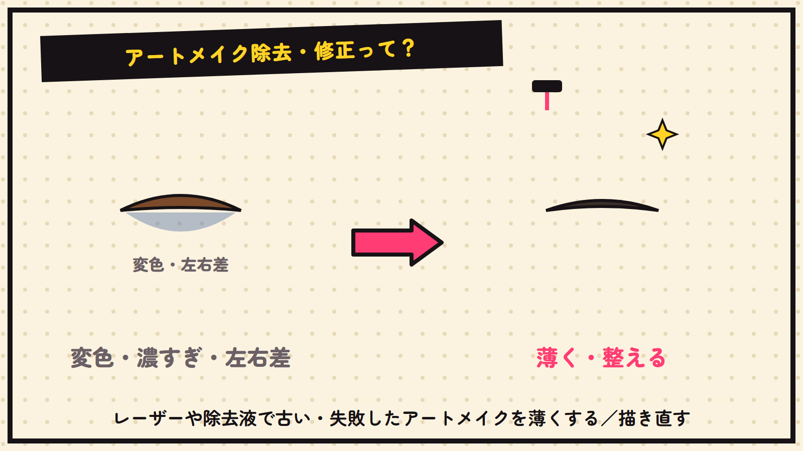 アートメイク除去・修正の図解