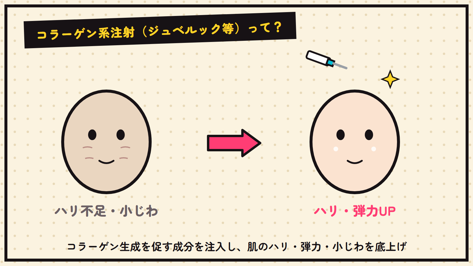 コラーゲン系注射の図解