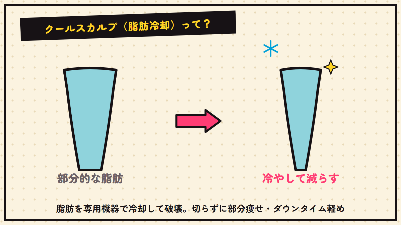クールスカルプ（脂肪冷却）の図解