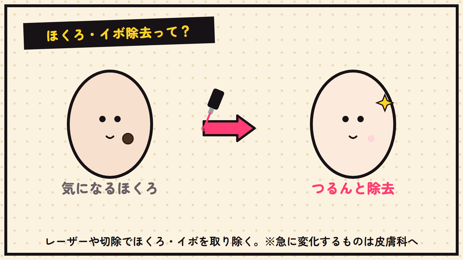 ほくろ・イボ除去の図解（ほくろを取り除く）