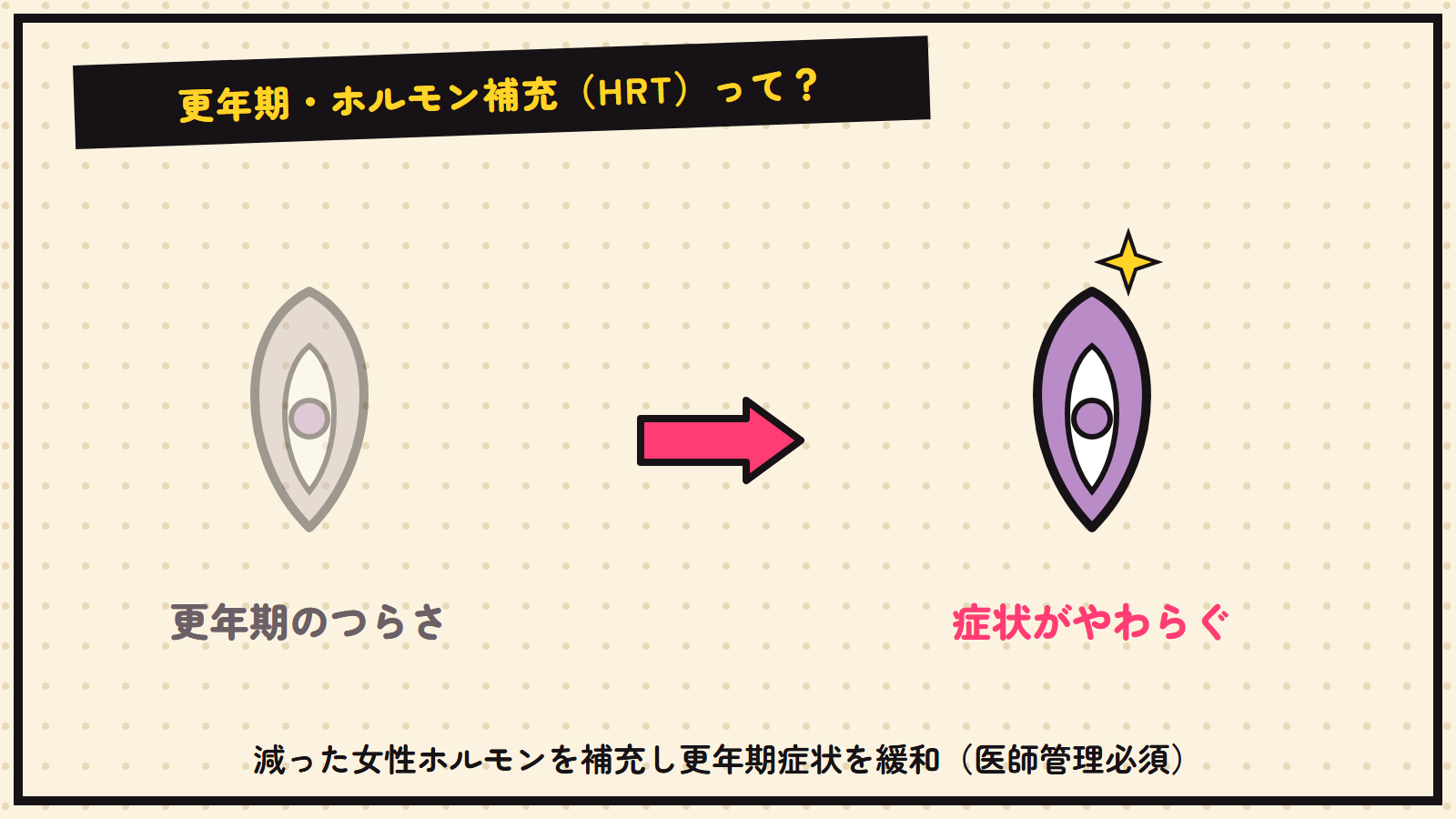 HRT・ホルモン補充療法の図解（抽象）