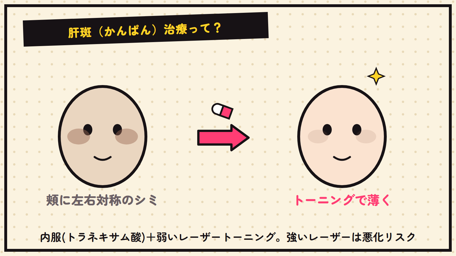 肝斑治療の図解