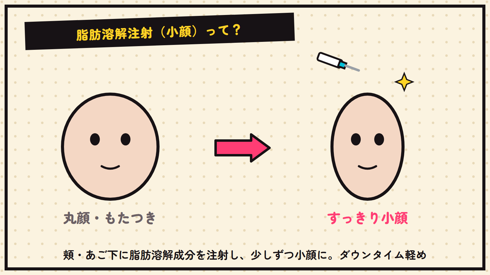 小顔の脂肪溶解注射の図解