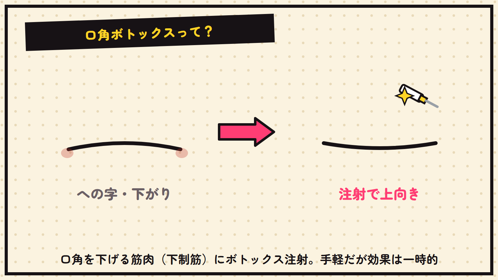 口角ボトックスの図解
