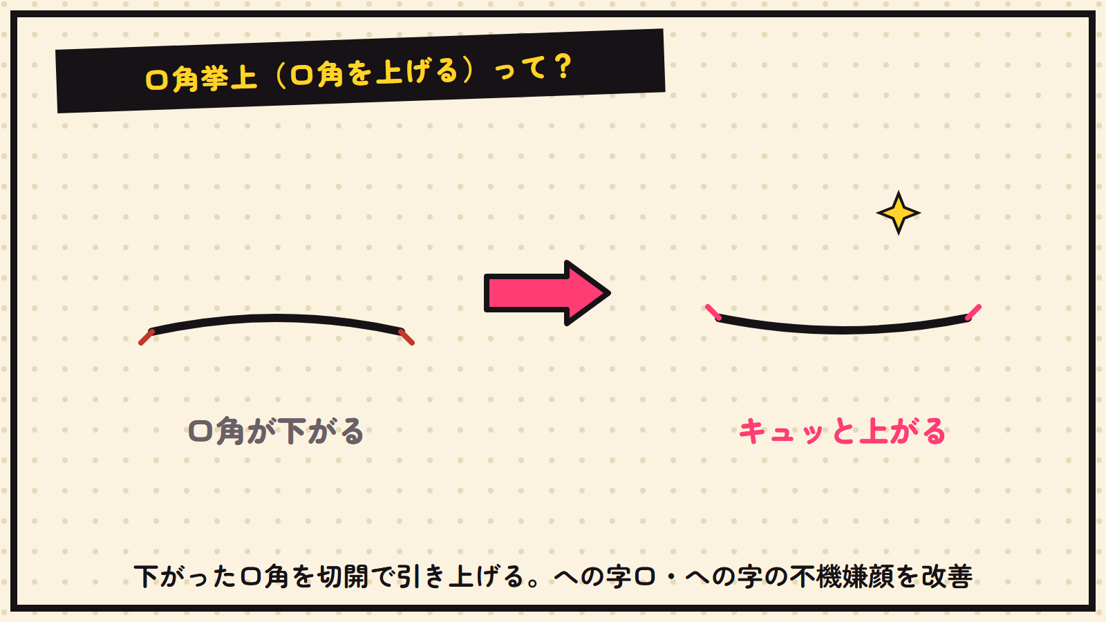 口角挙上の図解