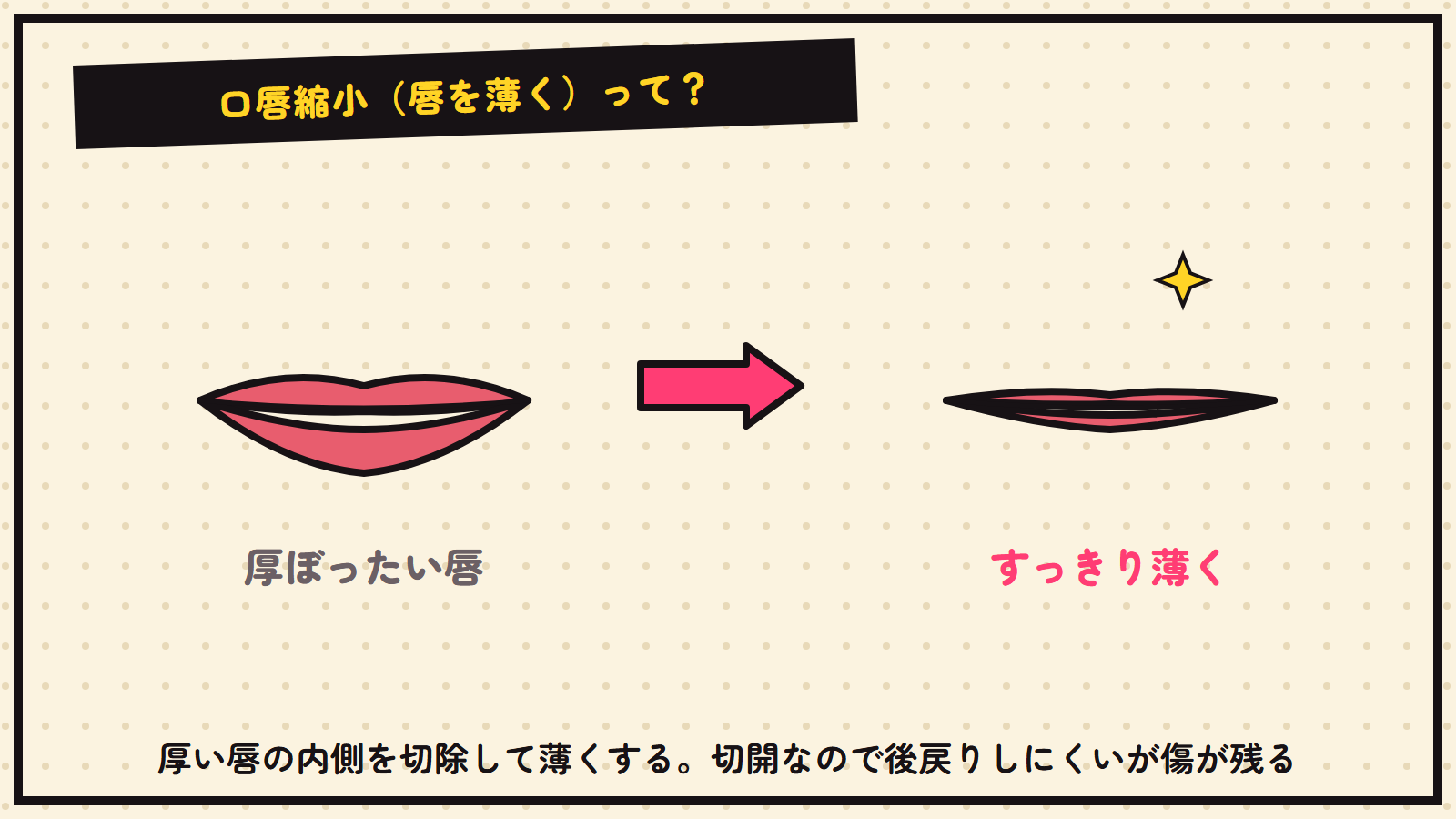 口唇縮小の図解