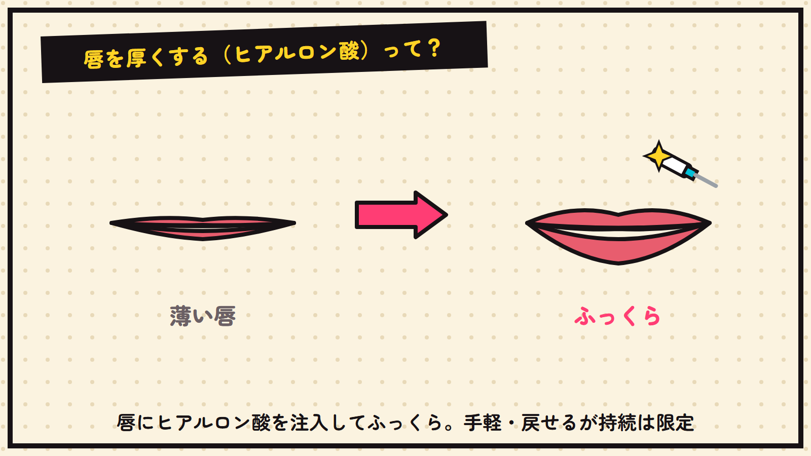 唇ヒアルロン酸の図解