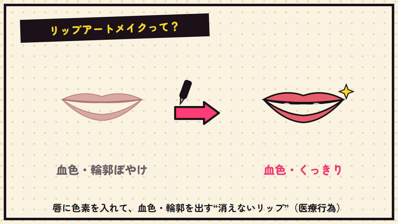 リップアートメイクの図解（血色・輪郭を出す）