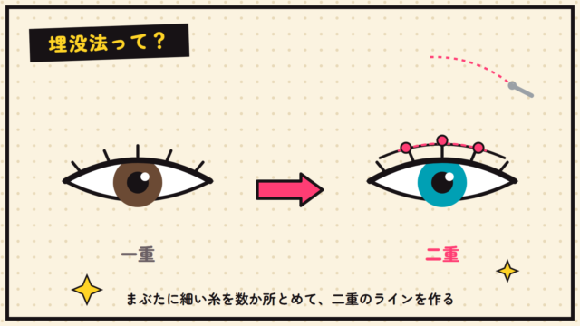 埋没法の図解イラスト