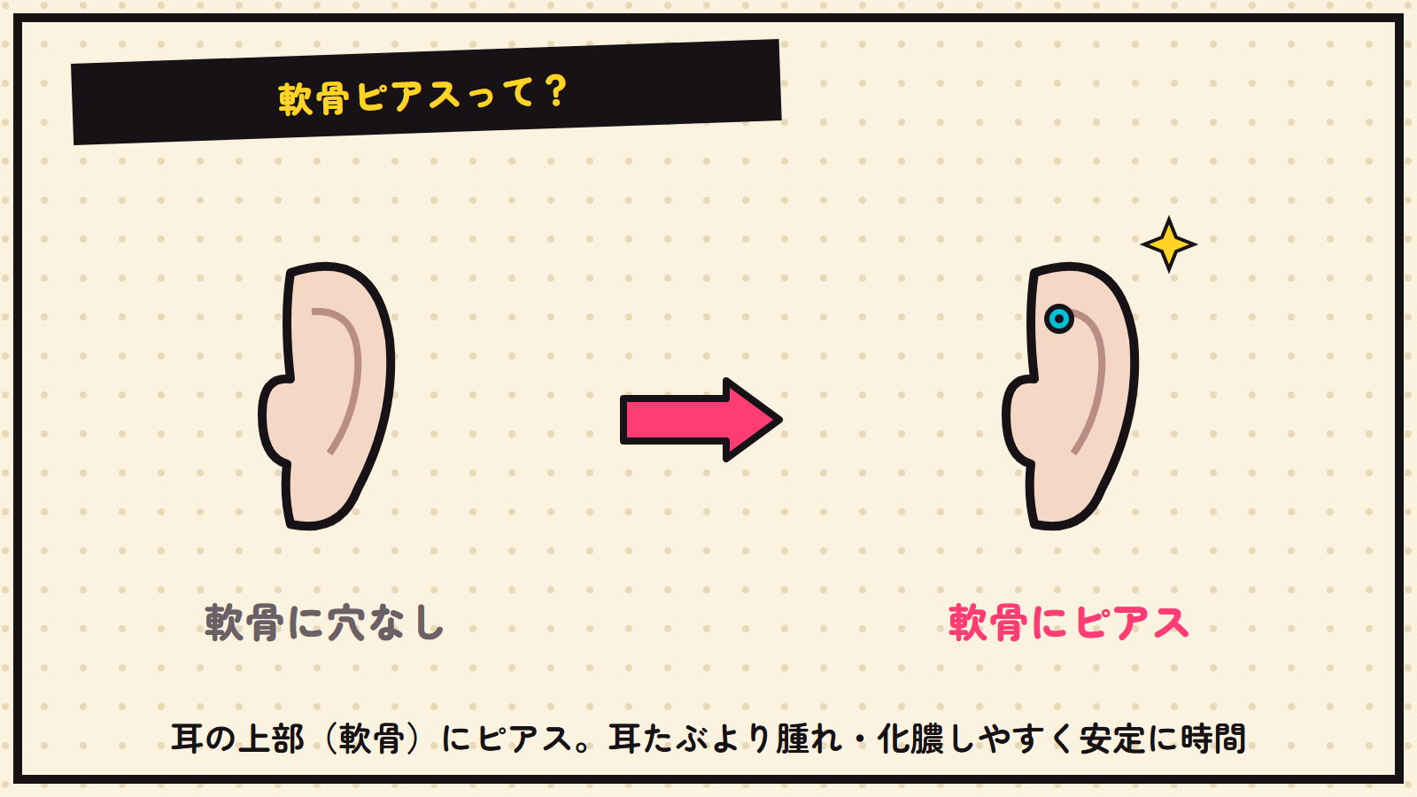 軟骨ピアスの図解