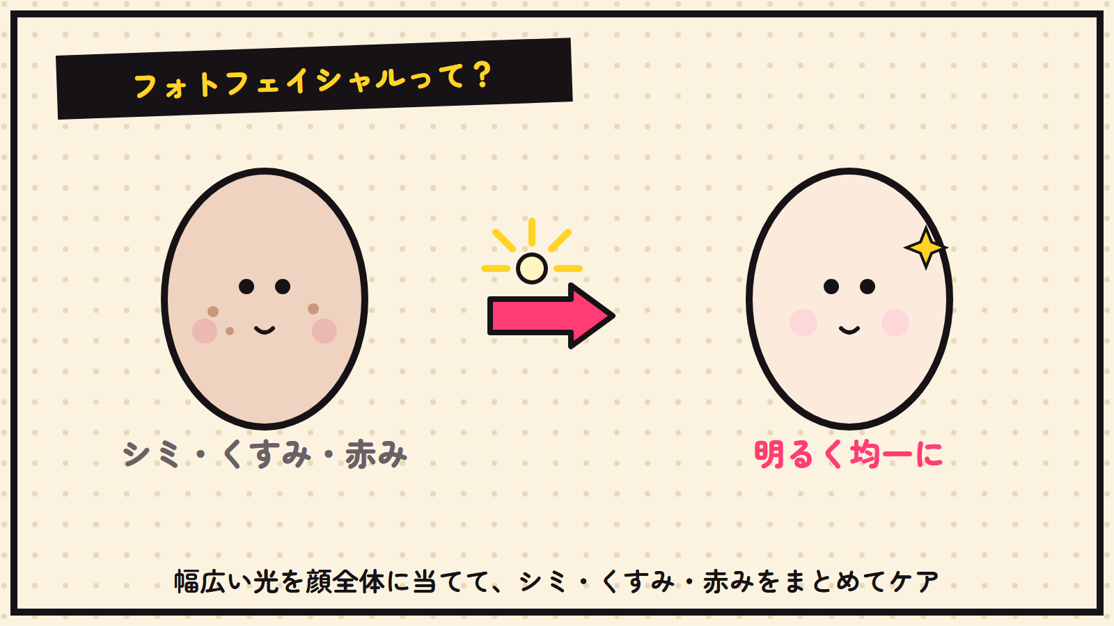 フォトフェイシャルの図解（シミ・くすみ・赤み→明るく）
