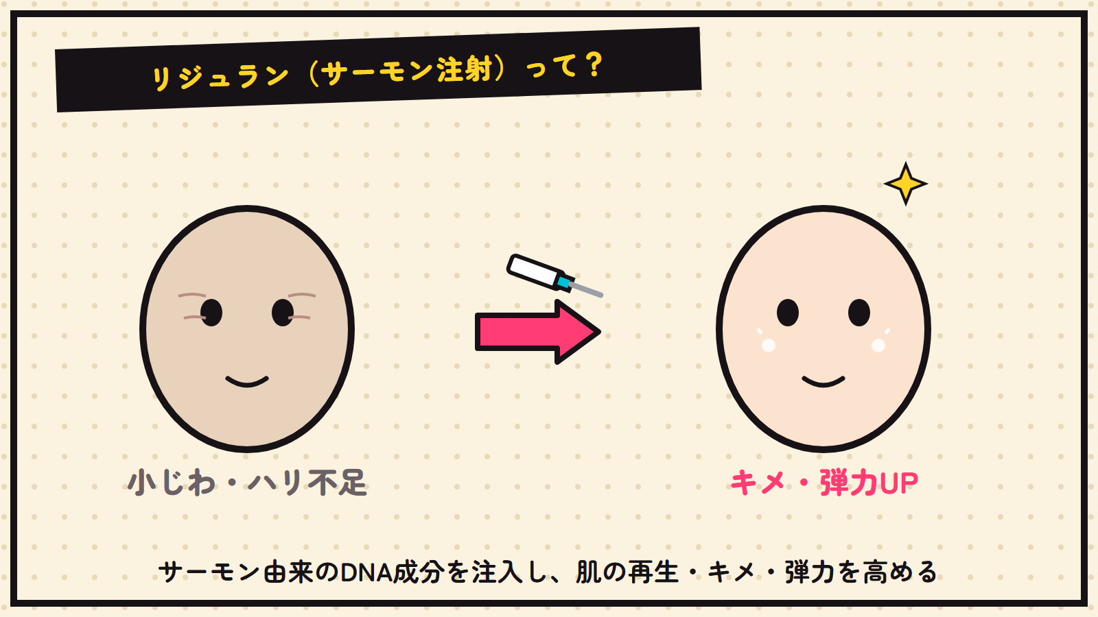 リジュラン（サーモン注射）の図解