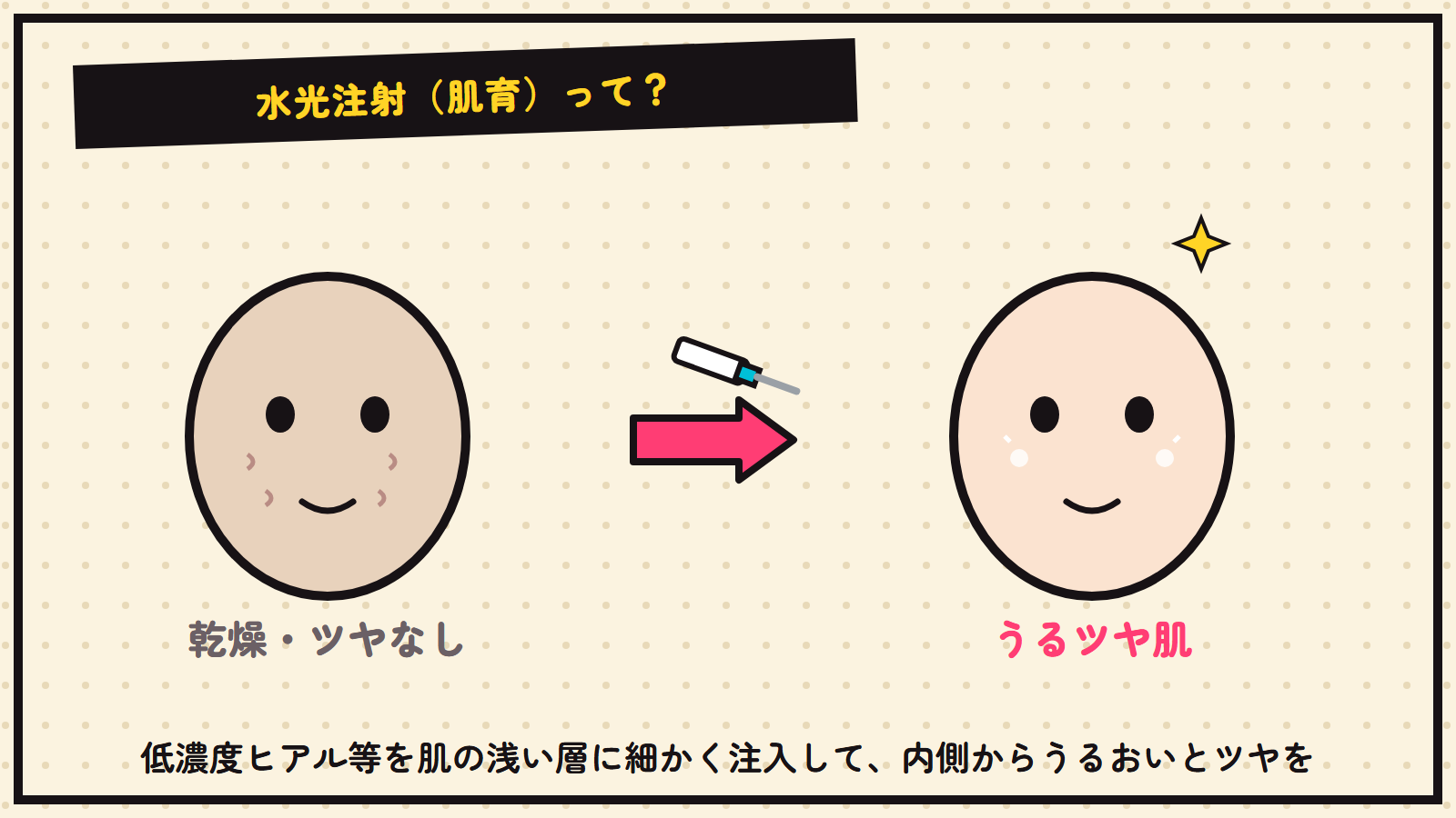 水光注射の図解