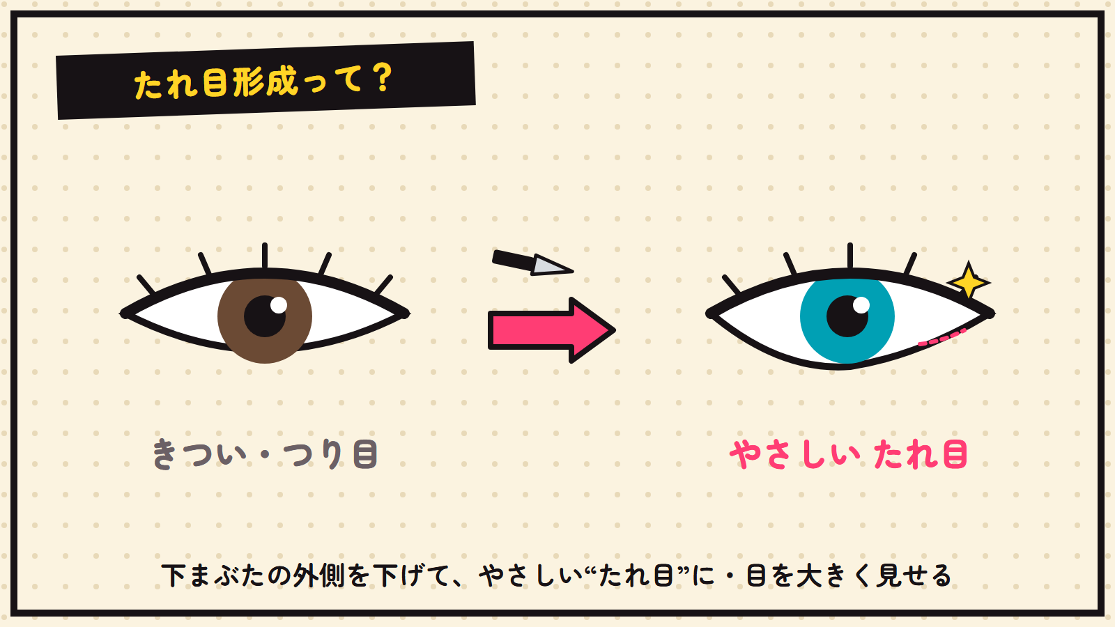 たれ目形成の図解（つり目→やさしいたれ目）