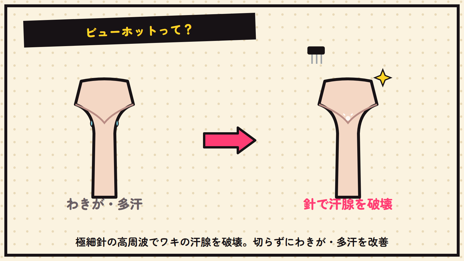 ビューホットの図解
