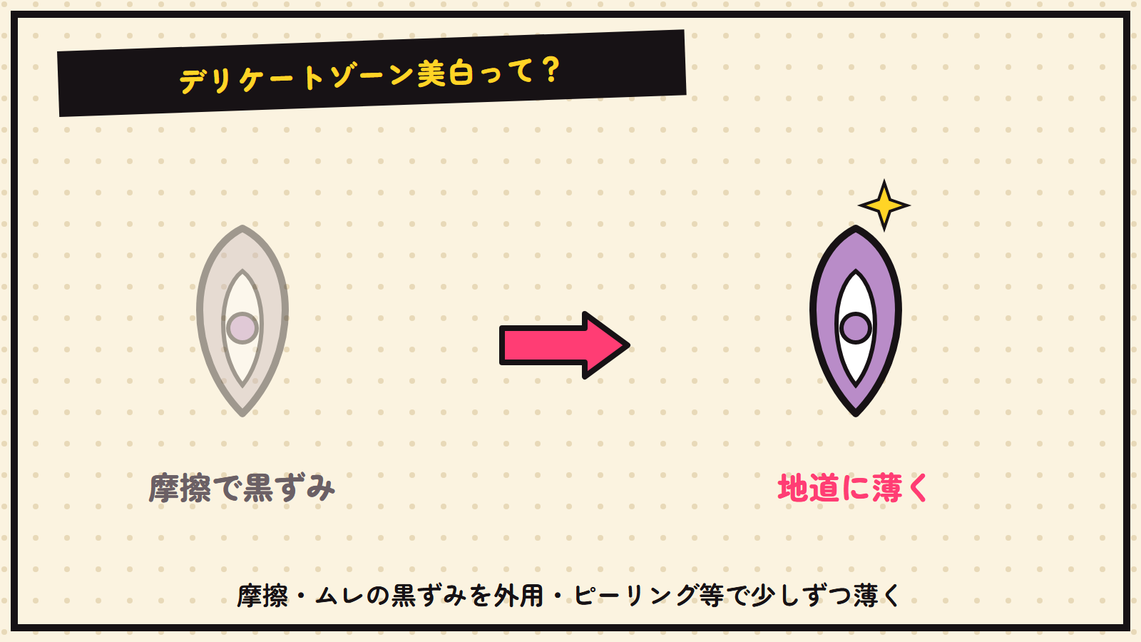 デリケートゾーン美白の図解（抽象）